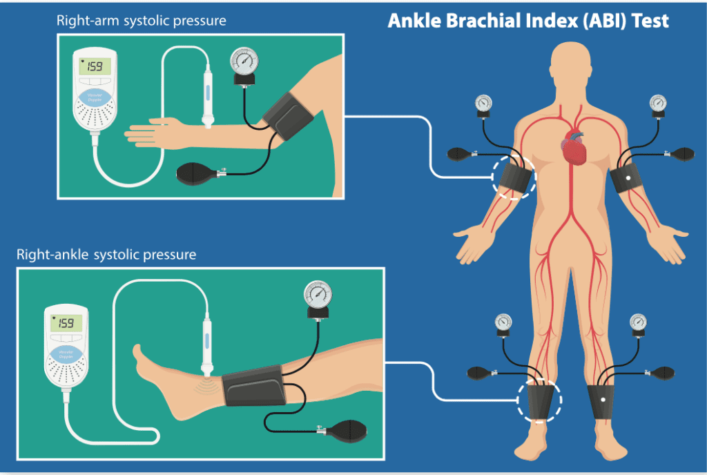 standard-test-still-best-for-evaluating-leg-pain-at-rest-heart-advisor